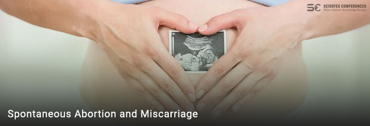 Spontaneous Abortion and Miscarriage